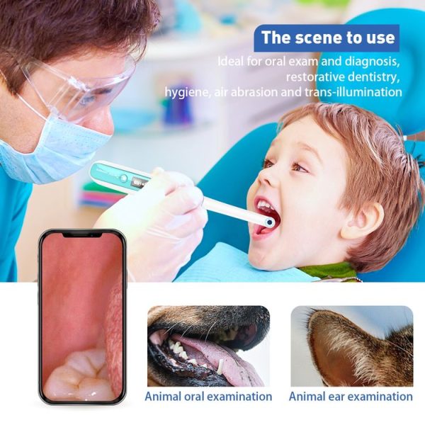 Inskam401 1080P Household Visual WiFi HD Intraoral Camera Endoscope - Image 8