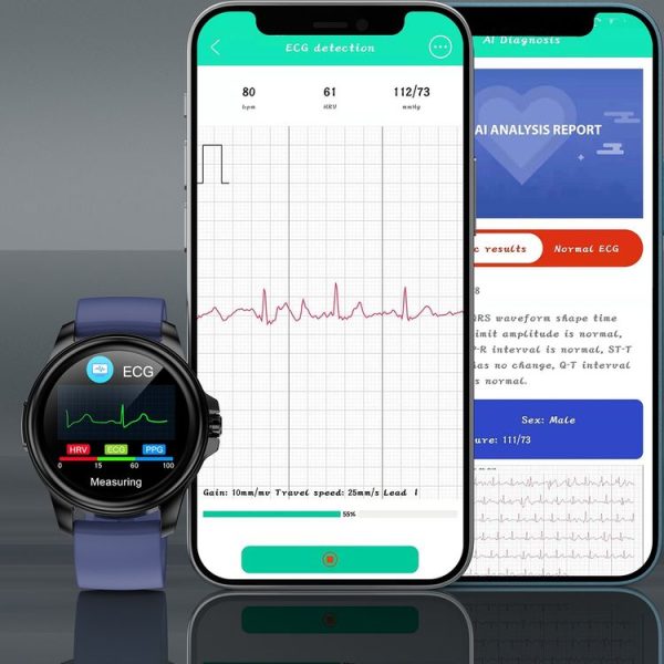 E89 1.32 Inch Screen TPU Strap Smart Health Watch Supports ECG Function, AI Medical Diagnosis, Body Temperature Monitoring (Dark Blue) - Image 6